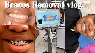 Braces Before And After Removal  No More Crooked Smile 😃 … [upl. by Furtek]