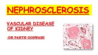 Nephrosclerosis [upl. by Atiuqehs]