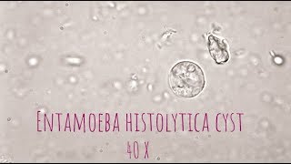 Entamoeba Histolytica cyst under microscope at 40X [upl. by Nicole]