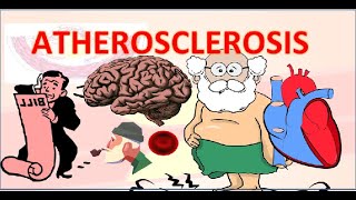 Atherosclerosis in hindi  एथेरोस्क्लेरोसिस  pathophysiology  pathogenesis [upl. by Akselav]