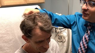 Hair Loss Treatment  Finasteride  Minoxidil  RetinA  UPDATE  Los Angeles [upl. by Laro3]