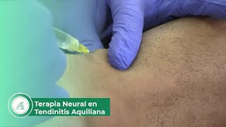 Terapia neural en tendinitis aquiliana [upl. by Ainoek]