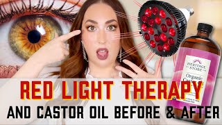 3 POWERFUL Castor Oil Benefits for THE FACE  WITH RED LIGHT THERAPY [upl. by Llertnauq920]