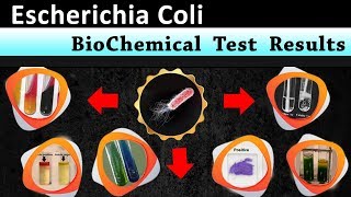 Escherichia coli Biochemical test results [upl. by Lotsirb205]