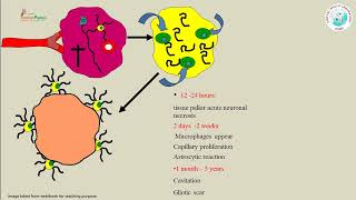 Cerebrovascular diseases [upl. by Oswal]