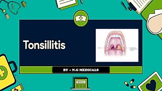 Tonsillitis  tonsil ke lakshan  टॉन्सिल को जड़ से खत्म करने का उपाय NGMedicals [upl. by Miriam]