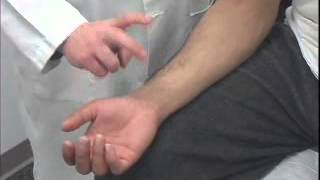 Tinels Test of the Carpal Tunnel [upl. by Deeanne957]