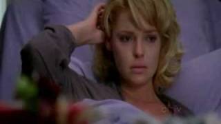 Bald Izzie in greys anatomy [upl. by Okomom]