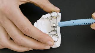 How to turn a palatal expander [upl. by Sirroned]