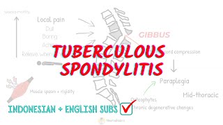 Tuberculous Spondylitis Overview and Treatment [upl. by Chelton]