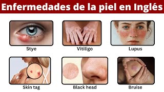 Enfermedades de la Piel en Inglés [upl. by Sayer]