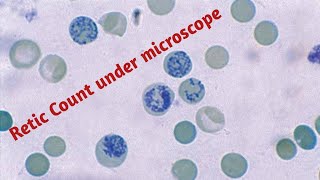 Reticulocyte  Reticulocyte count test in hindi [upl. by Nuajed]