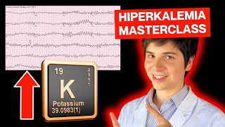 HIPERKALEMIA TRATAMIENTO MASTERCLASS en 10 minutos o menos [upl. by Ahsillek539]