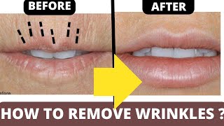 HOW TO REMOVE WRINKLES  MOUTH LINES [upl. by Acysej]