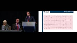 CPC COH2018  Case 2  Masked hypertension contributing to severe hypertensive HD [upl. by Nnyllaf]