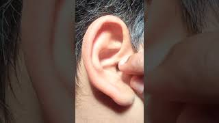 General Ear Examination In ENT Department [upl. by Thora]