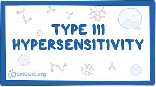 Type III hypersensitivity immune complex mediated  causes symptoms amp pathology [upl. by Atinaw228]