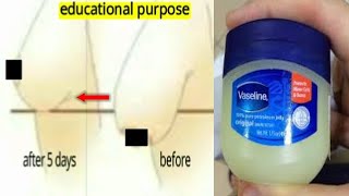 TIGHTEN SAGGING BREAST IN 5 DAYS USING VASELINE AT NIGHT result in demo [upl. by Anidal]