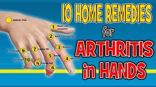 10 Home Remedies for Arthritis in Hands  Pain Relief Diet [upl. by Cida316]