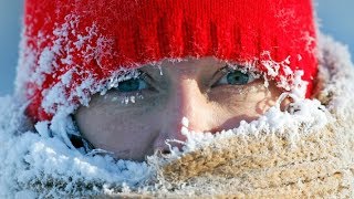 Why frostbite happens how to protect yourself [upl. by Aicenet]