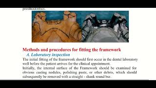 Fitting the removable partial denture framework [upl. by Bazil]