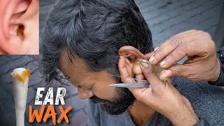 Wax Removal Inside Ear  Dirtiest Ear Cleaning on Street  Indian Street Ear Cleaner [upl. by Ahcsap]