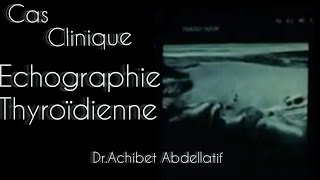 Cas clinique Echographie thyroïdienne  Dr Achibet Abdellatif [upl. by Munster208]