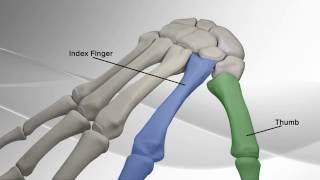 Thumb Metacarpal Arthritis Repair with Arthrex® CMC Mini TightRope® [upl. by Sexton87]