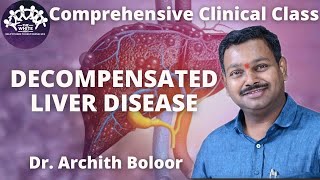 DECOMPENSATED LIVER DISEASE clinical case presentation [upl. by Atipul]