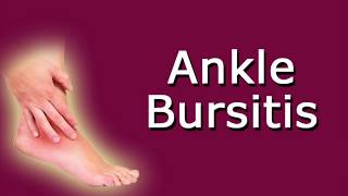 Ankle Bursitis [upl. by Trab43]