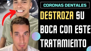 ⛔️Destroza sus DIENTES con CORONAS DENTALES sin necesidad  ¿Diseño de sonrisa [upl. by Keverian]