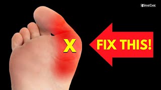 How to Relieve Bunion Pain at Home NO EQUIPMENT [upl. by Learsi459]