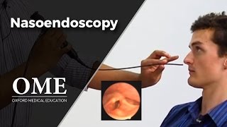 Nasoendoscopy Nose Examination  ENT [upl. by Hana]