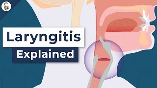 Why Do You Lose Your Voice  Laryngitis Explained [upl. by Elspet599]