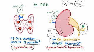 Familial Hypocalcuric Hypercalcemia FHH  Endocrinology and Nephrology [upl. by Sedecrem76]