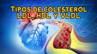 Tipos de colesterol LDL HDL y VLDL [upl. by Darum]