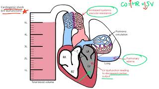 Shock for the USMLE Step 1 [upl. by Balfour342]