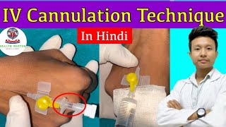 Intravenous Cannulation Technique  IV Cannulation Procedure  IV Cannula  Health Sector [upl. by Angadreme793]