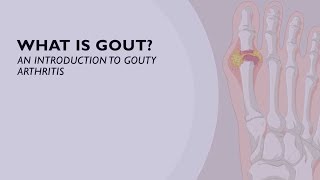 What is Gout An Introduction to Gouty Arthritis 1 of 6 [upl. by Ginger176]