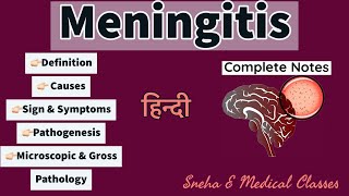 Meningitis Pathology  Hindi  Gross amp Microscopic Pathology  Pathogenesis  Hindi [upl. by Yankee]