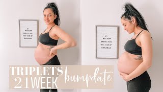 TRIPLETS 21 WEEKS pregnant update symptoms baby updates NAMES [upl. by Nnov185]