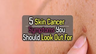 5 Skin Cancer Symptoms You Should Look Out For [upl. by Machute]