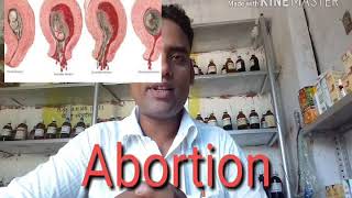 abortion homeopathic medicines in hindi by dr ajay srivastava [upl. by Curson418]