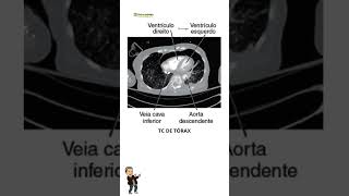 TC DE TÓRAX radiologia tecnologoemradiologia tomografia [upl. by Joscelin]