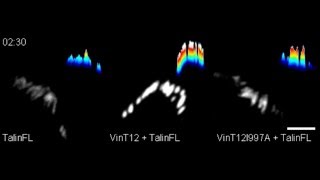 Vinculin controls talin engagement with the actomyosin machinery [upl. by Zap64]