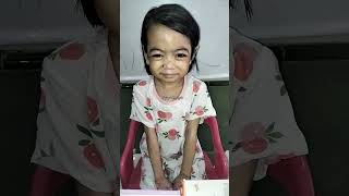 Epidermolysis Bullosa shortvideo epidermolysisbullosa shorts [upl. by Sosanna]