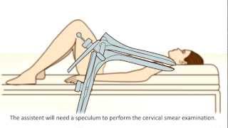 A cervical screening test  What can you expect [upl. by Natsirt]