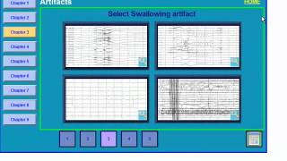 EEG Artifacts [upl. by Eiznikcm]