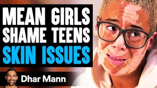 MEAN GIRLS Shame TEENS SKIN ISSUES What Happens Next Is Shocking  Dhar Mann [upl. by Stelmach]