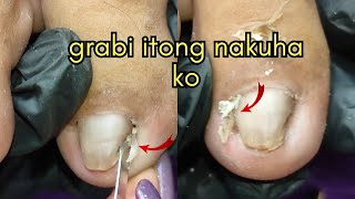 Vlog 950Dry SkinIngrown Removal PEDICURE 850 [upl. by Ateekahs]